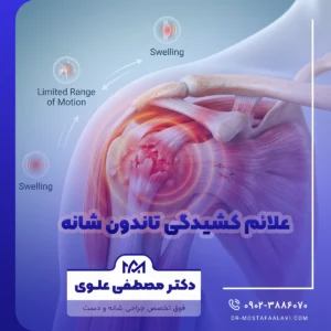علائم کشیدگی تاندون شانه