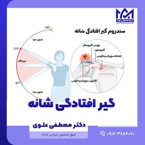 گیر افتادگی شانه