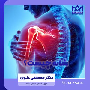 شانه چیست؟