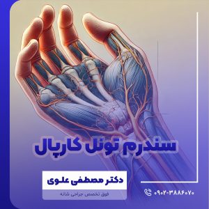 سندرم تونل كارپال