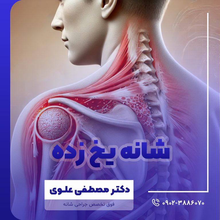 شانه یخ زده