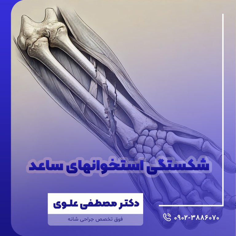 شکستگی استخوانهای ساعد