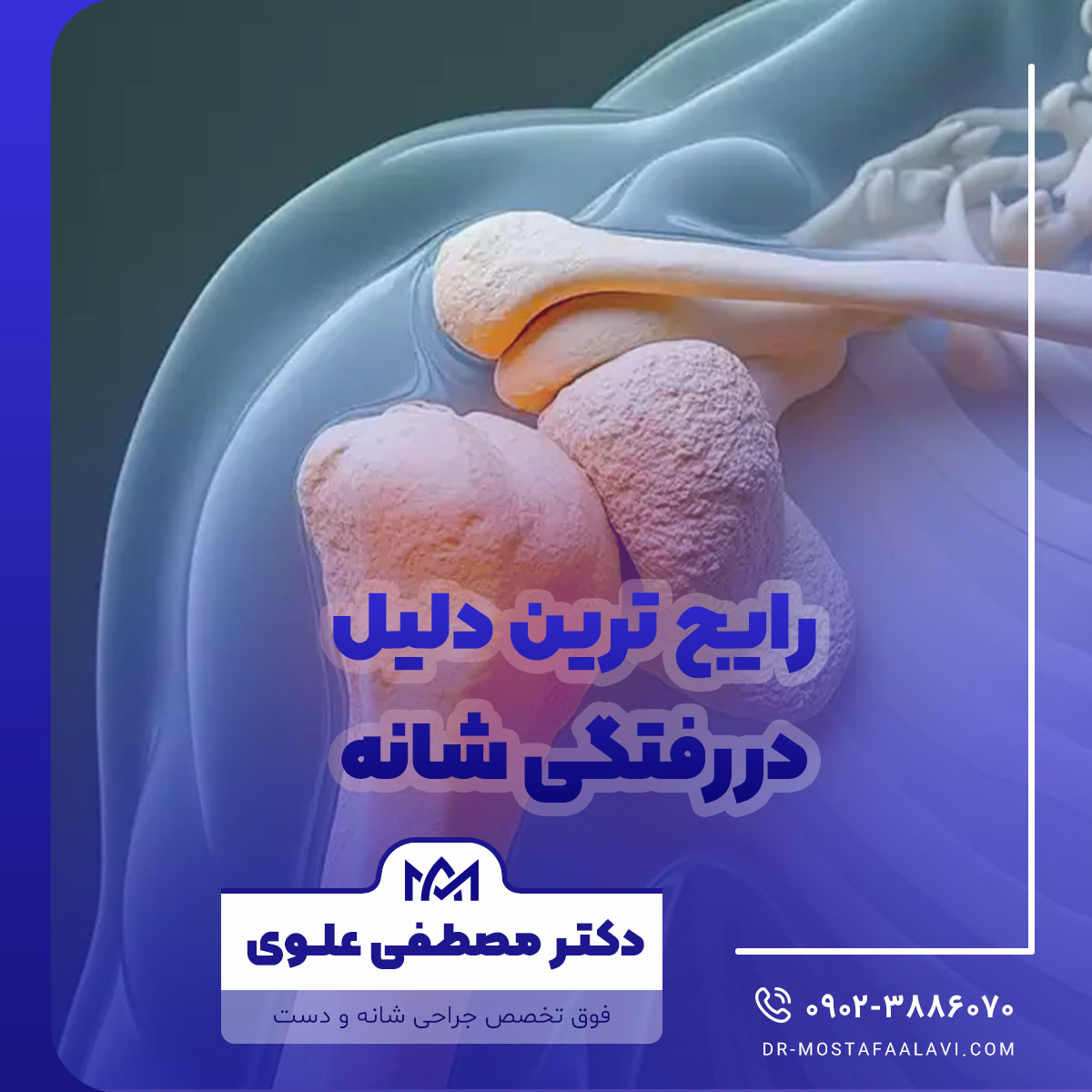 رایج ترین دلیل دررفتگی شانه