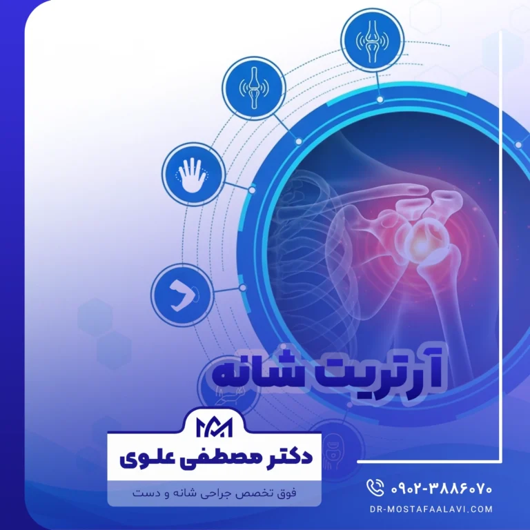 آرتریت شانه